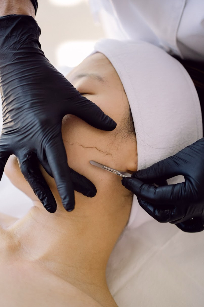 Dermaplane facial