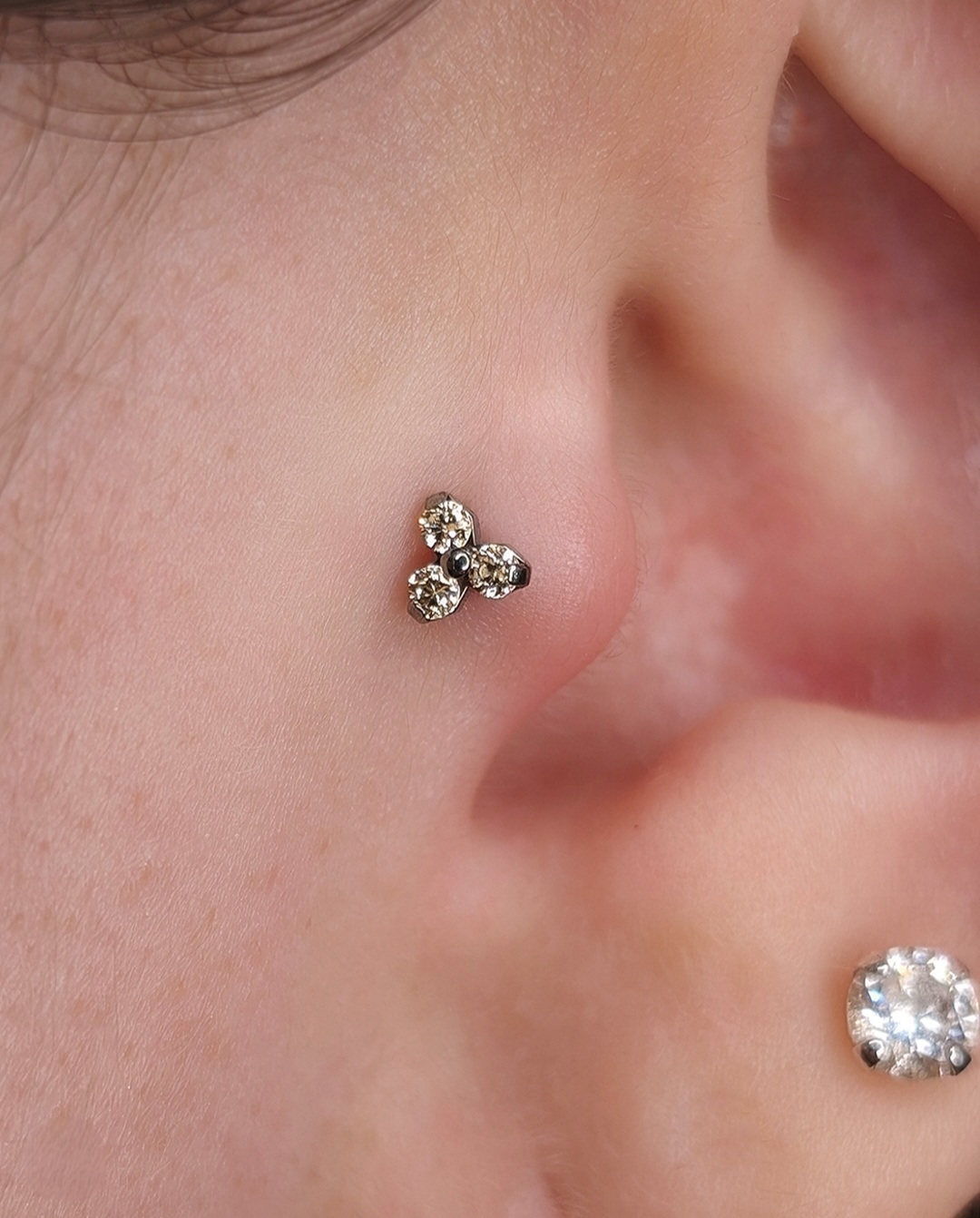Tragus