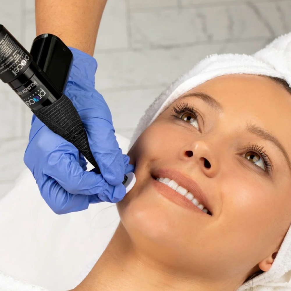ProCell Microchanneling at Restore Balance in Milford, DE