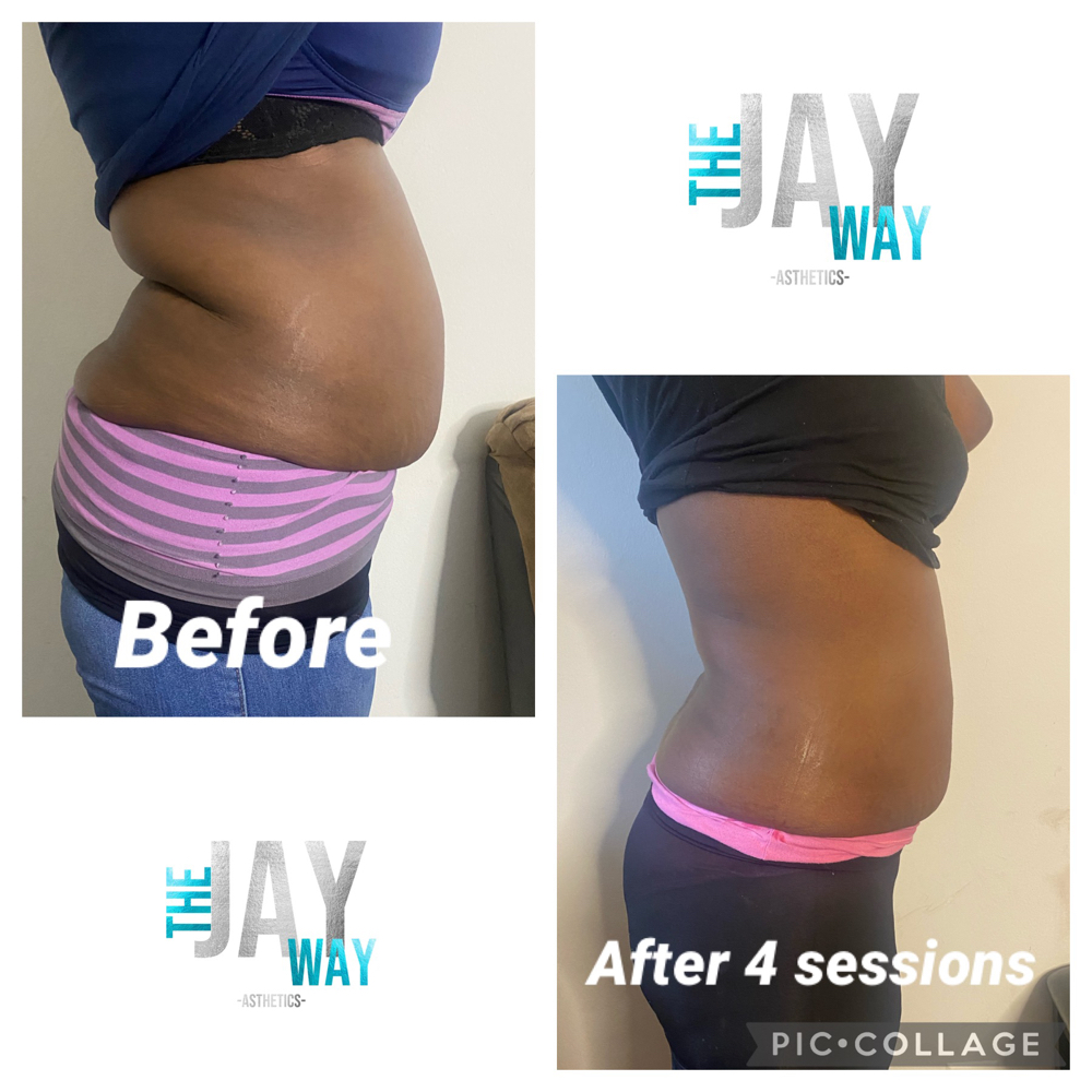 360 Contour (3 Sessions) Special
