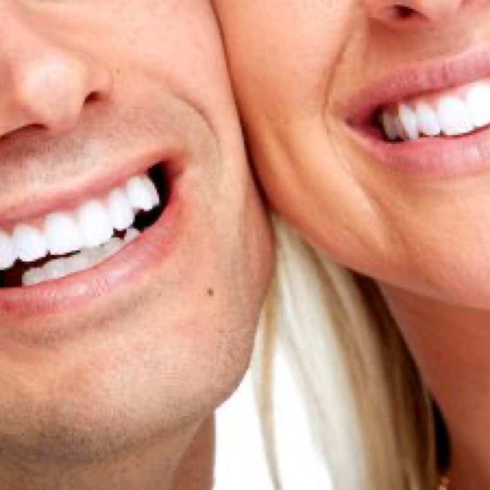 Teeth Whitening For 2 People at Rise Beauty Studio in Forest Grove, OR