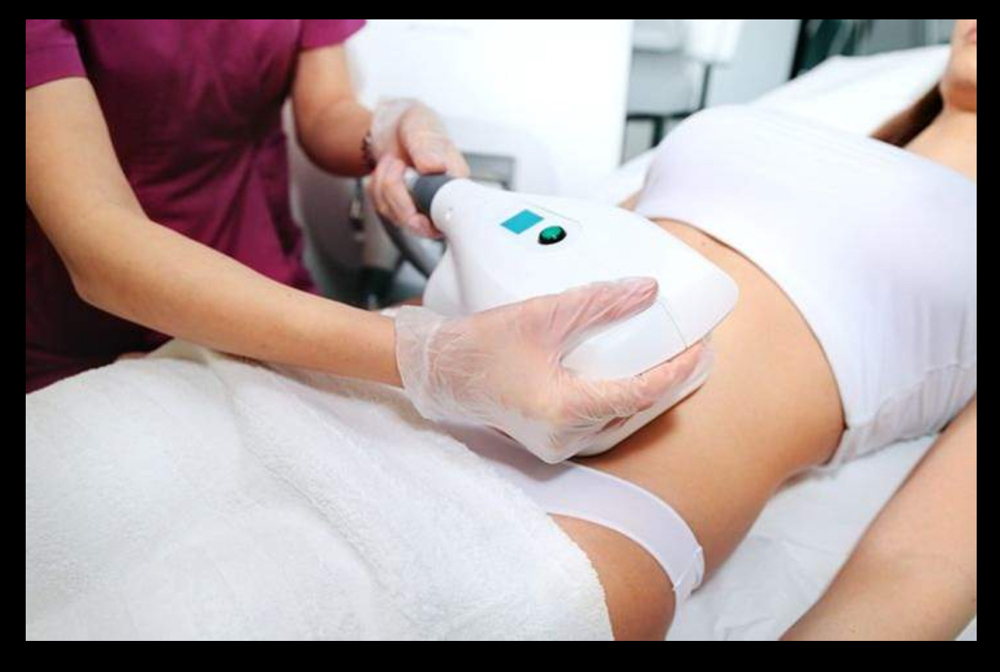 Bonexis Abdominal 10 Treatments