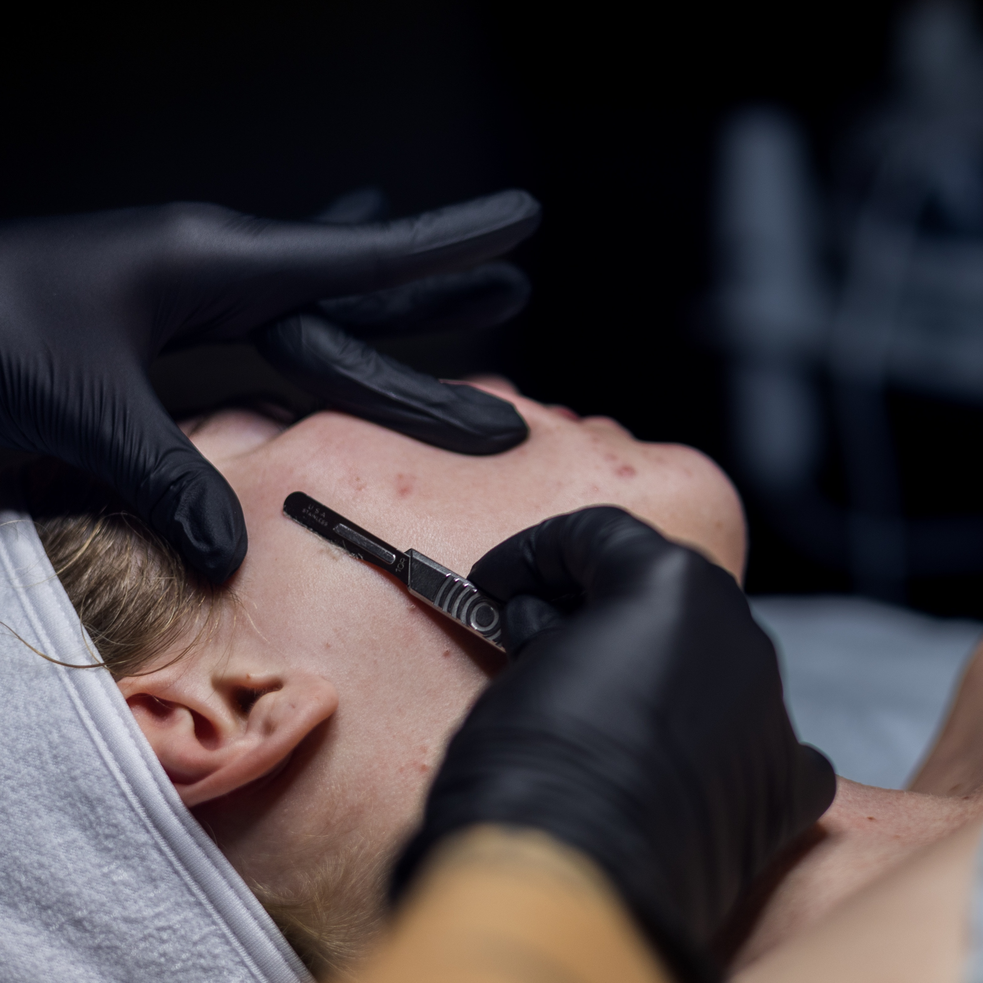 Dermaplaning Facial at Jade Esthetics in Oviedo, FL