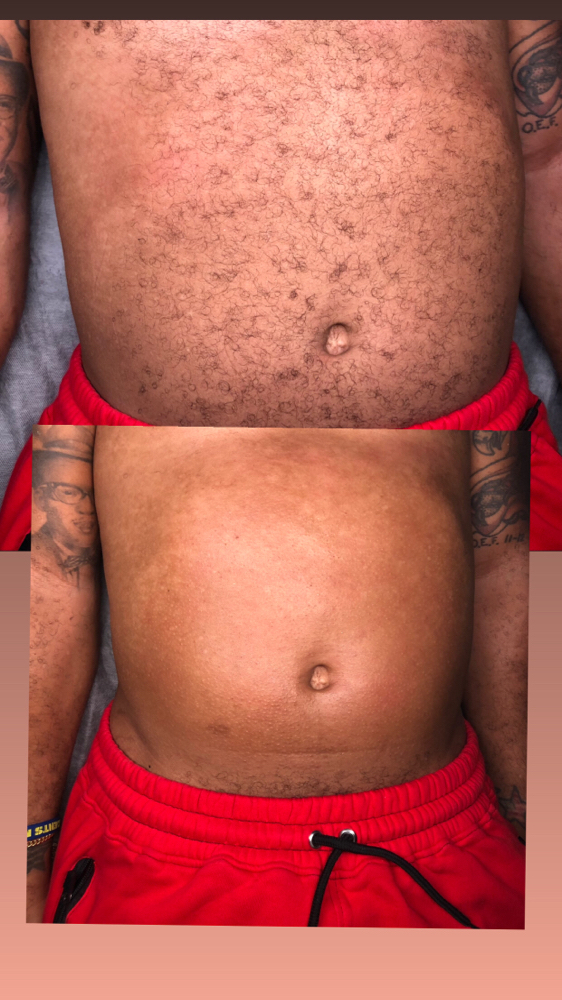 Stomach Wax - Men