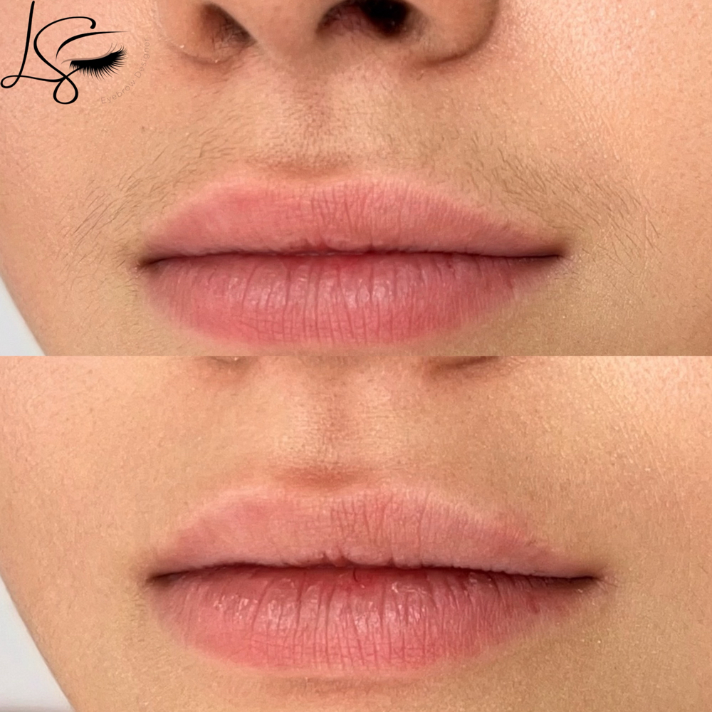 Buço Na Linha/Upper Lips