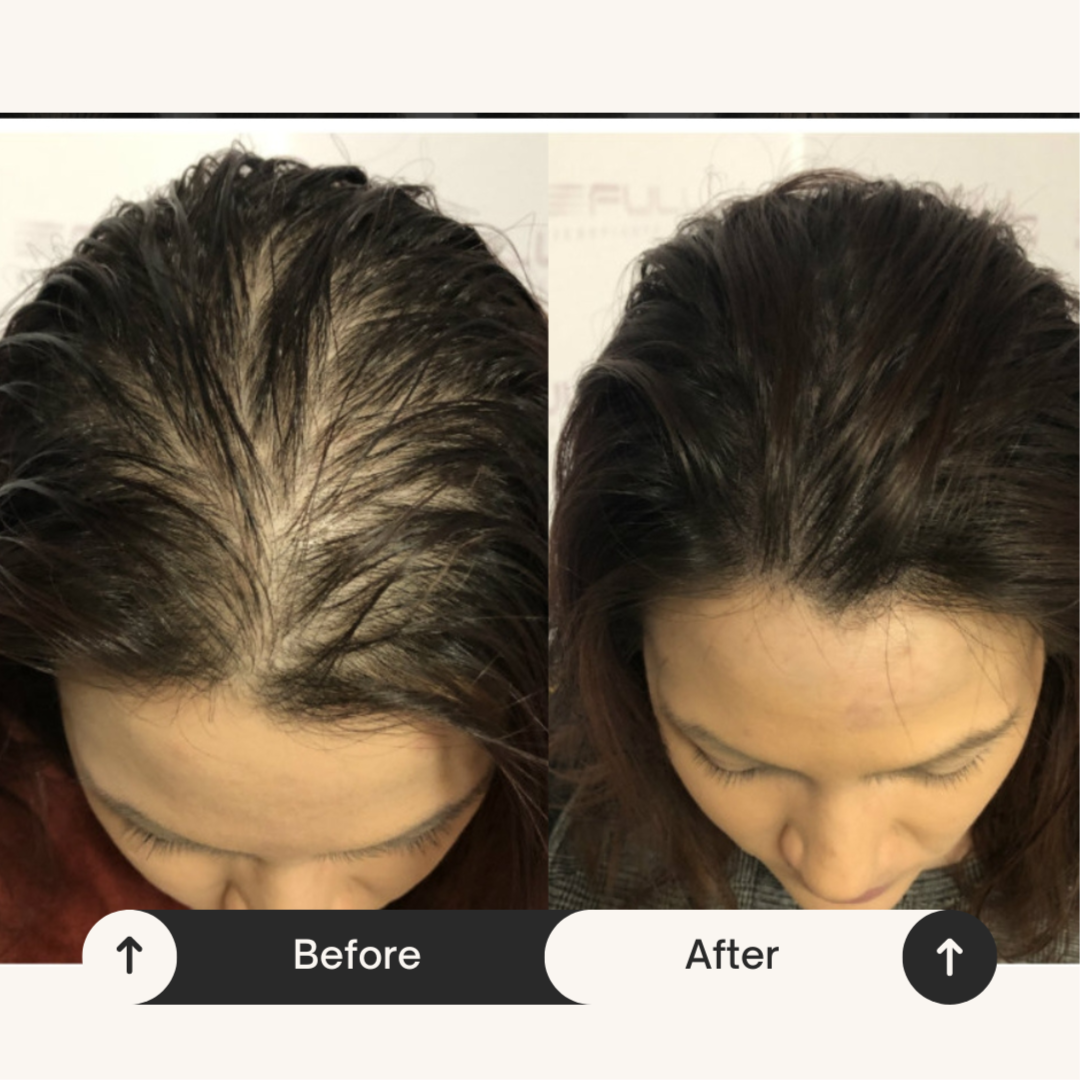Scalp Microshading at Spa Botanicals in Covina, CA