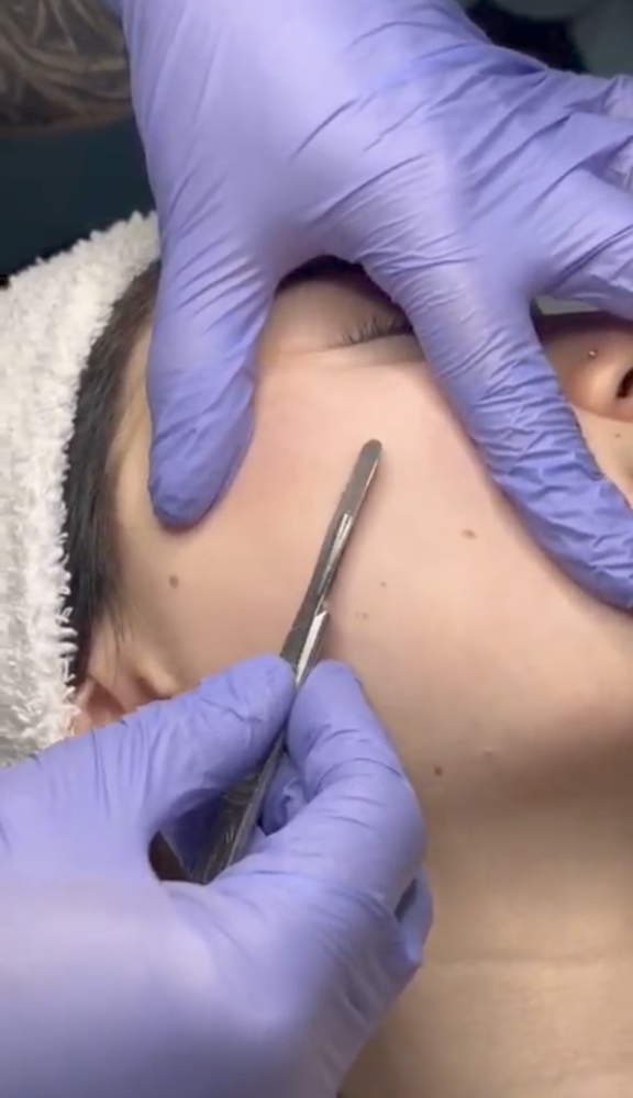 Dermaplane Add On