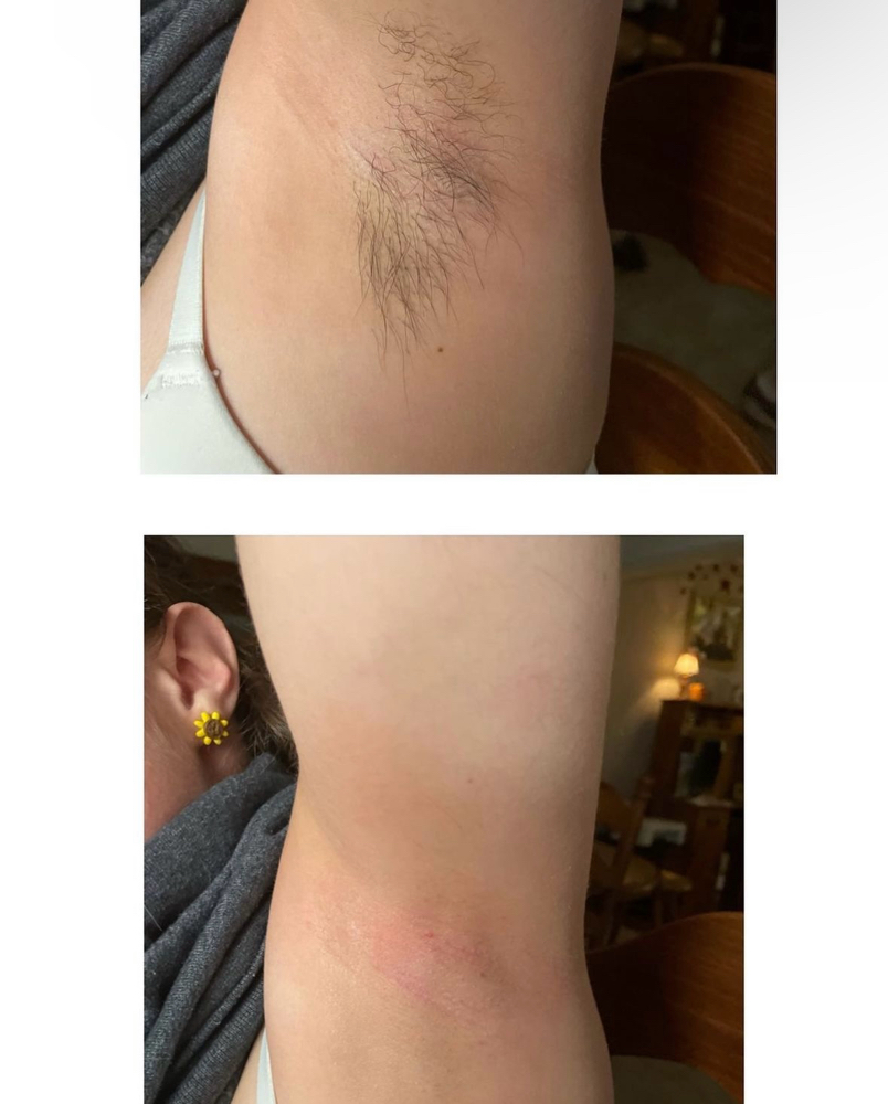 Underarm Wax