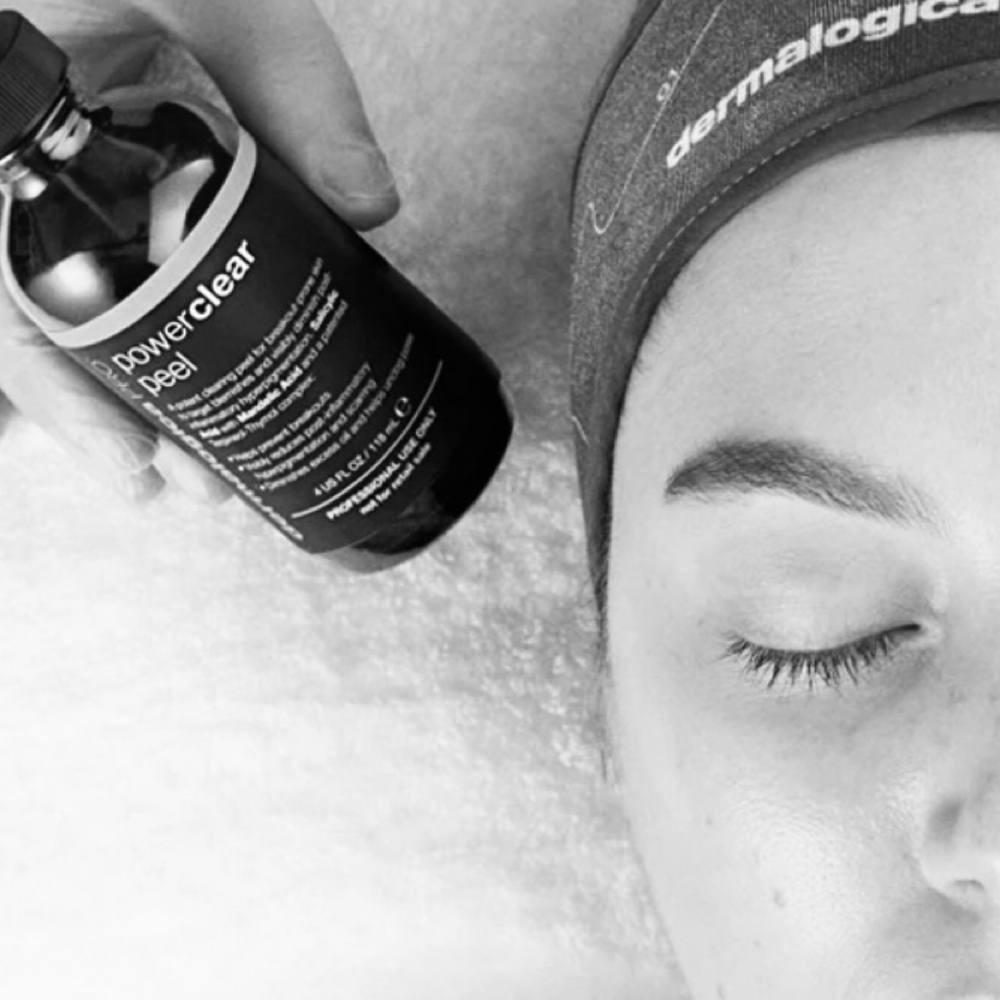 Power Clear Peel at SkinByIzabella in Toledo, OH