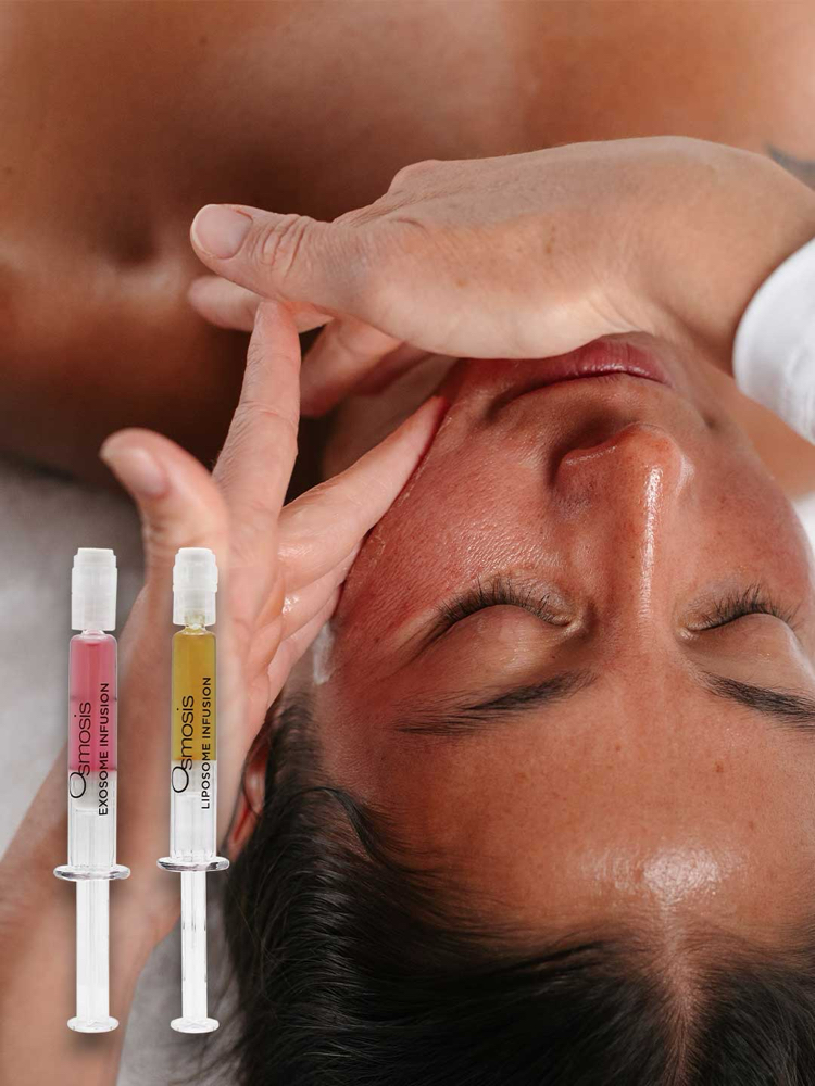 Exosome Infusion skin ritual