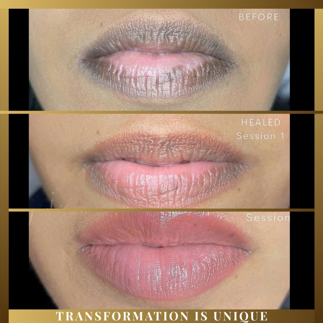 Lip Neutralization