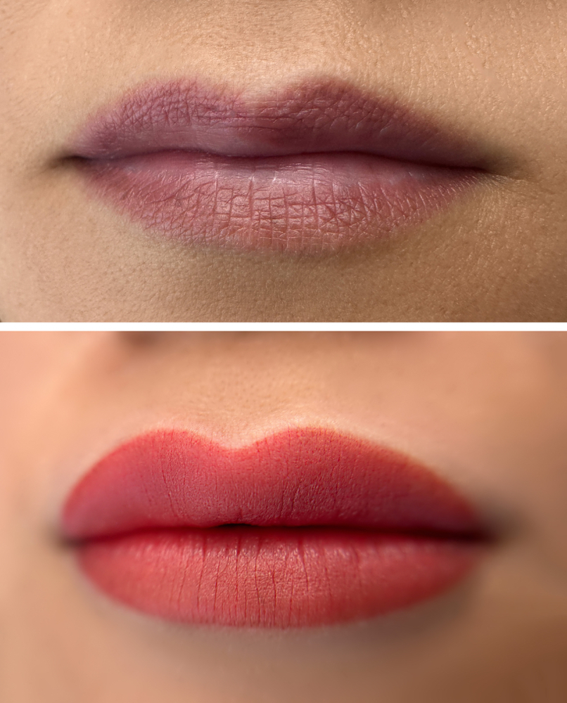Lip Neutralization