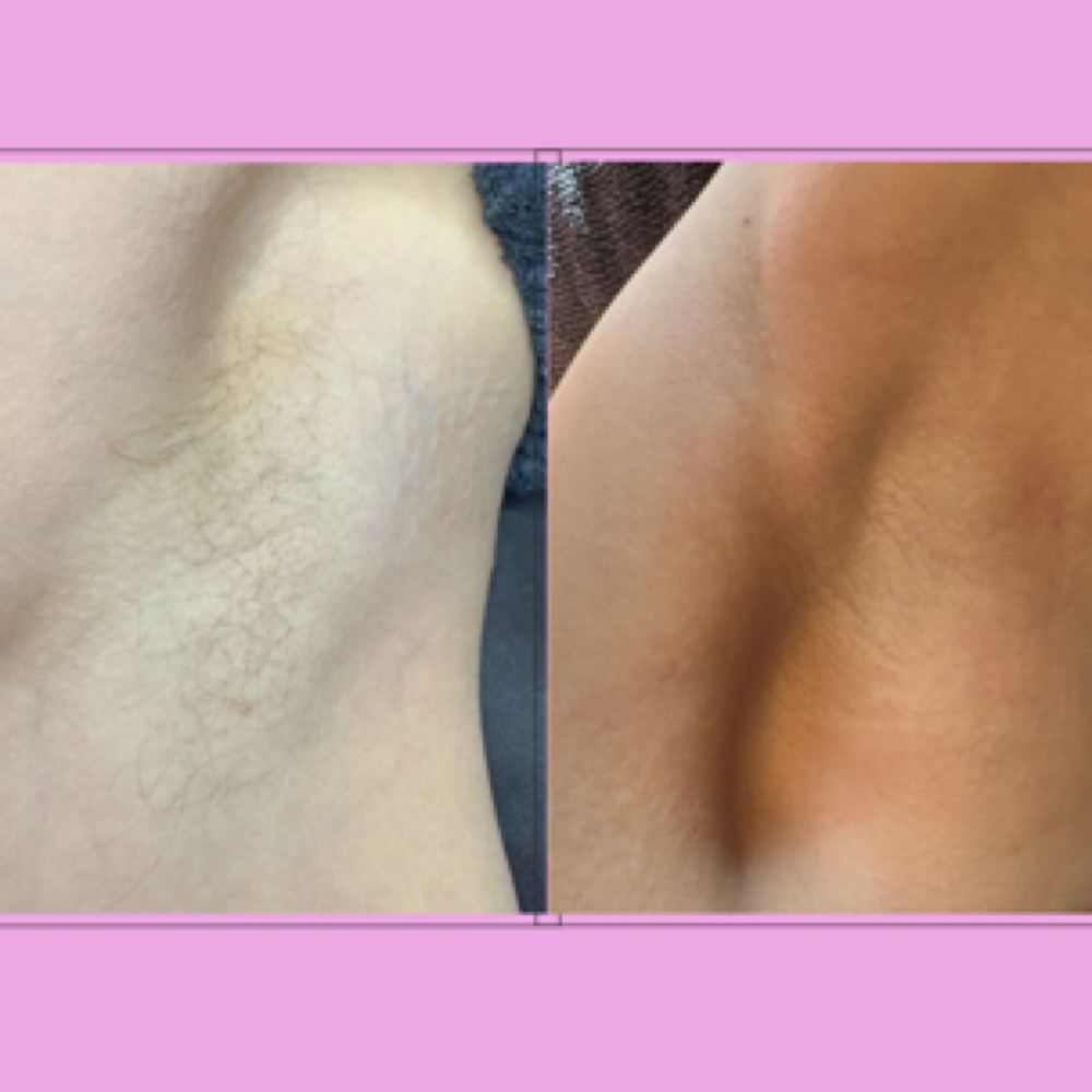 Armpit Wax at Beyond Skin By Lena in Parma Heights, OH