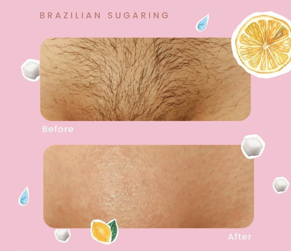 Full Bikini Sugar Wax