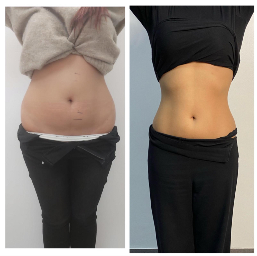 BODY & FACE SCULPTING