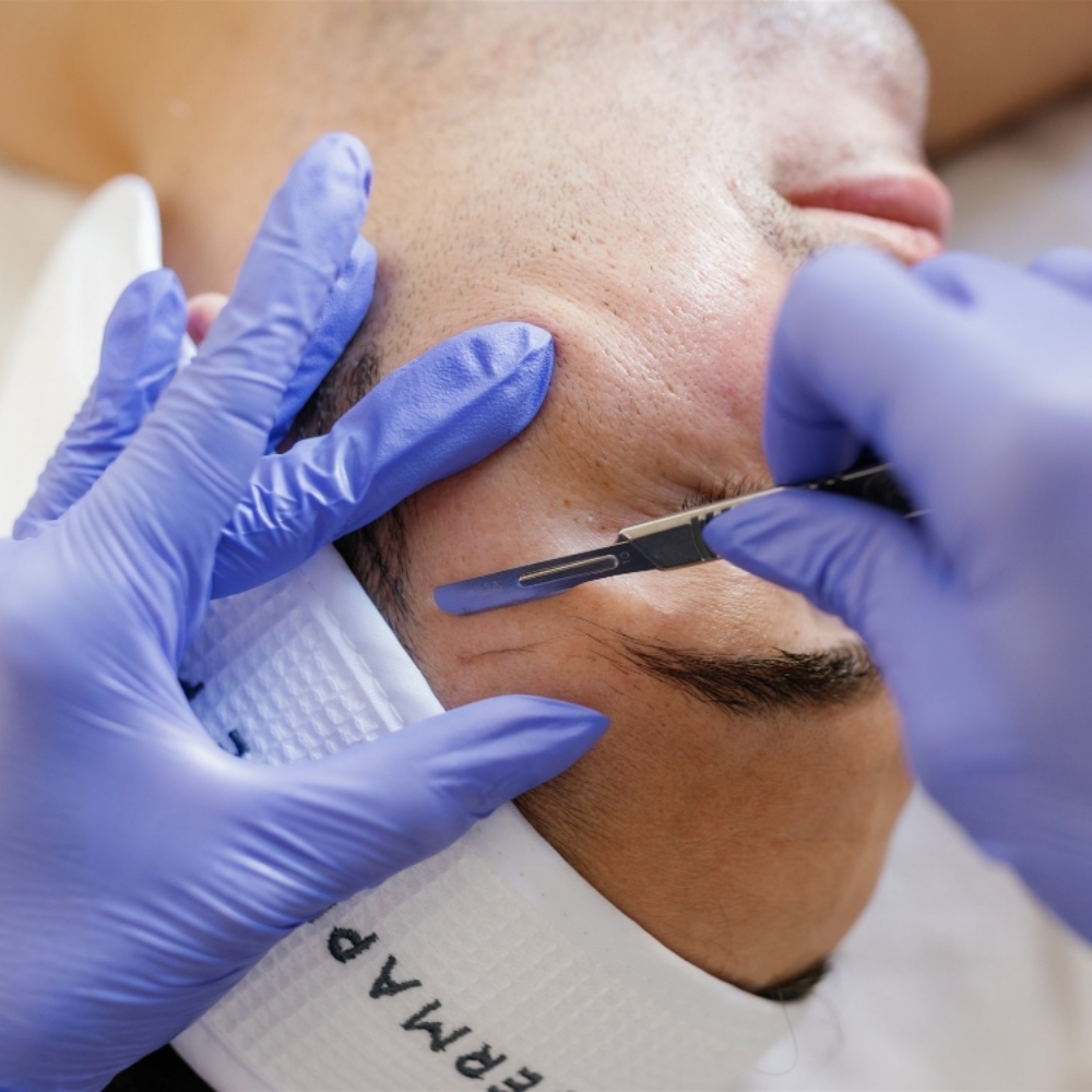 Add-on Dermaplane Upgrade at Triple Moon Aesthetics in Albuquerque, NM