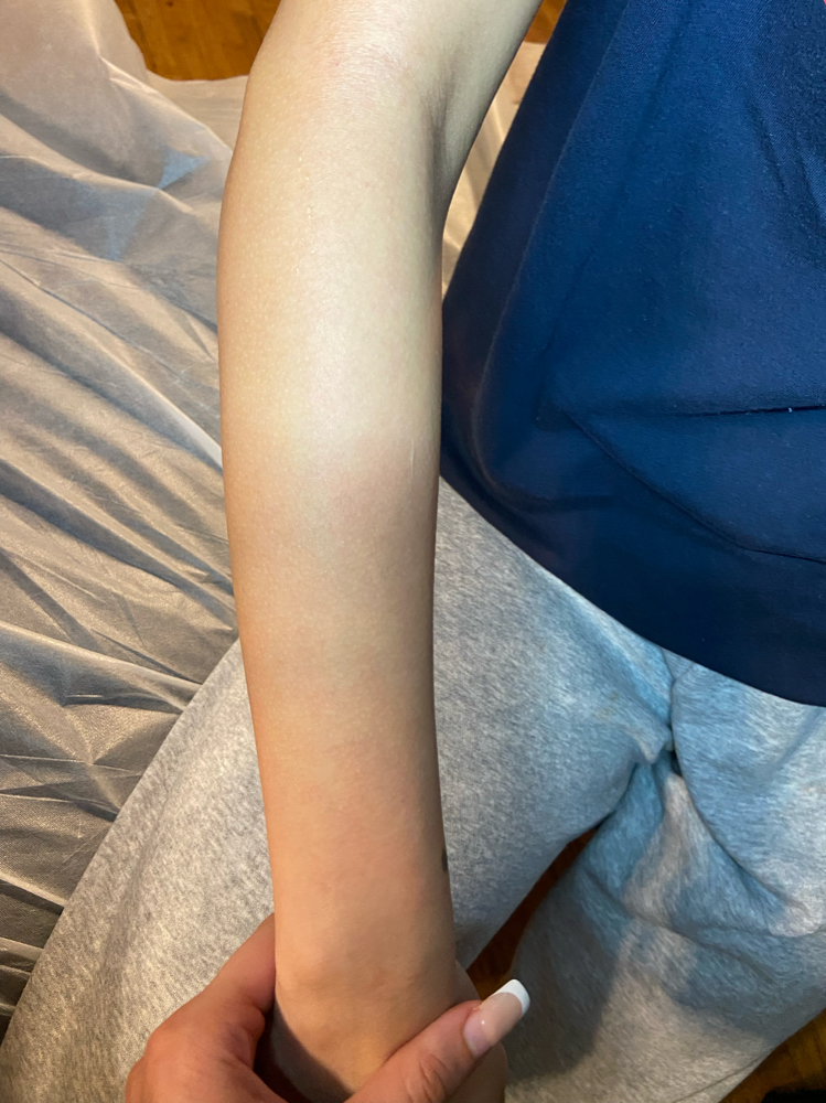 Full Arms