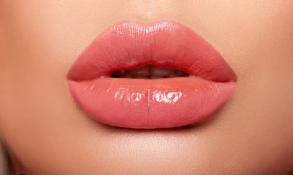 Lip filler 2 Week Touch Up