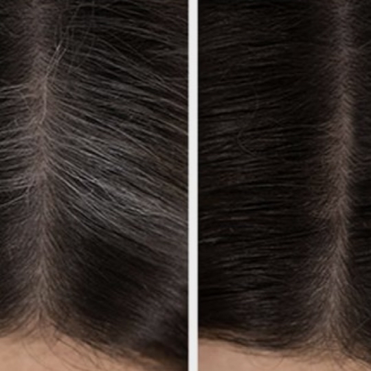 Root Touch Up