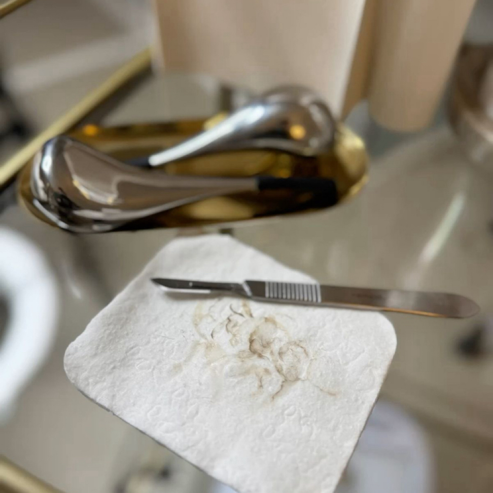 Dermaplane Facial at LUXX Beauty Studio in Tucson, AZ