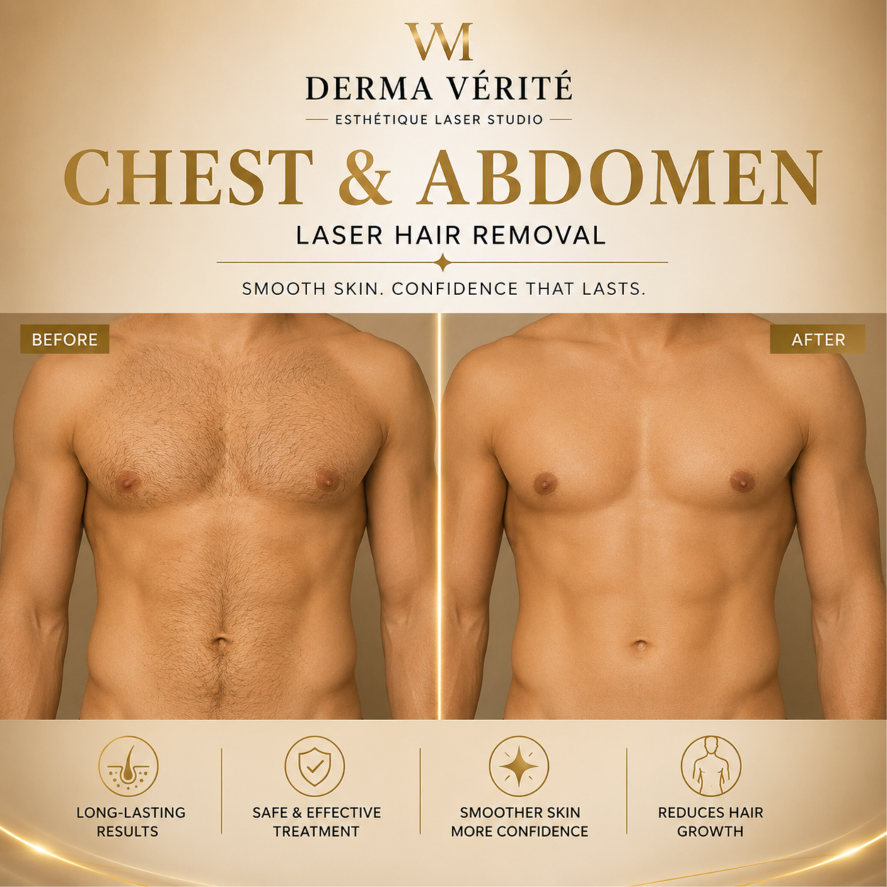Abdomen Laser Hair Removal at Derma Verite Esthetique Laser Studio in Elmhurst, NY