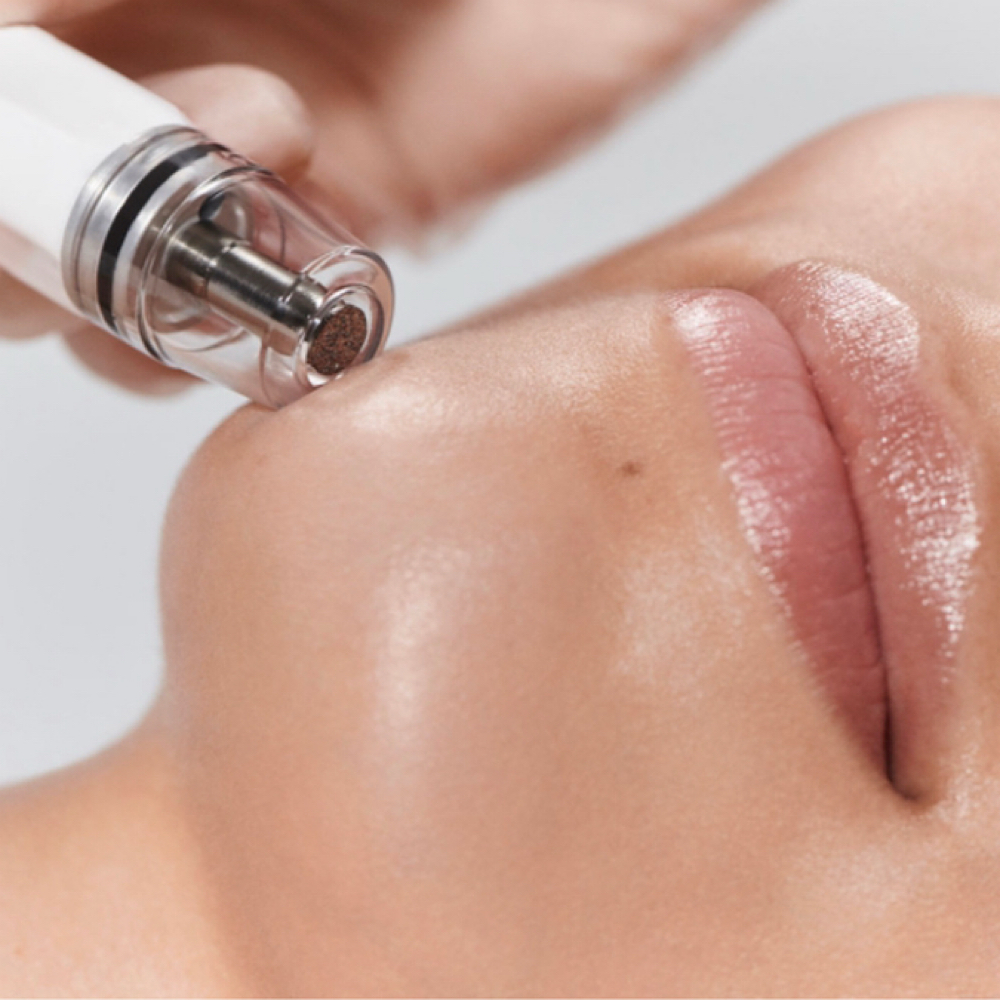DIAMOND GLOW FACIAL at Javani Aesthetics & Wellness in Bay City, MI
