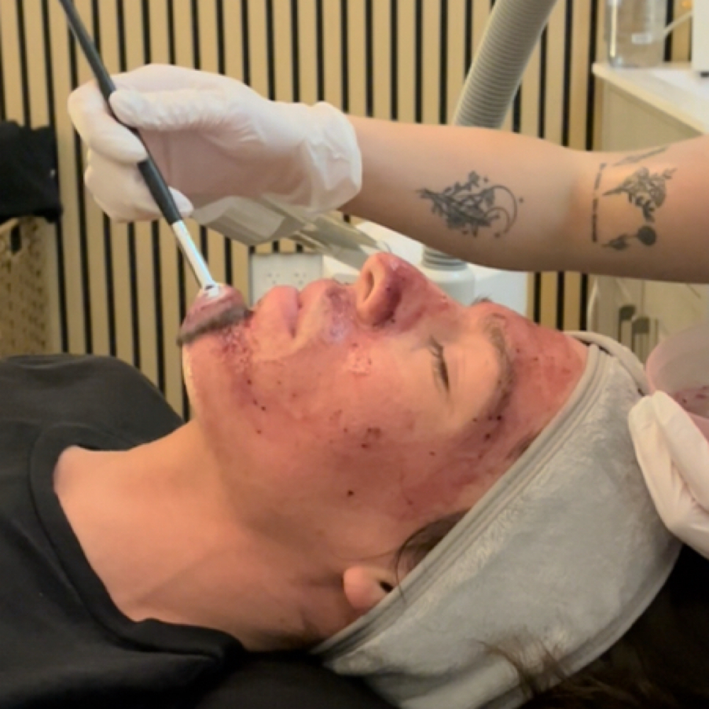 Signature Facial at Lotus Moon Esthetics in Mesa, AZ
