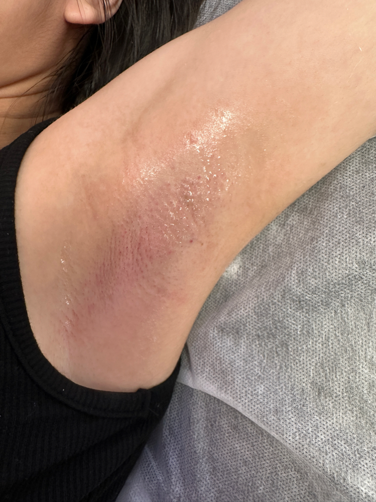 Under-Arm Facial + Wax Package