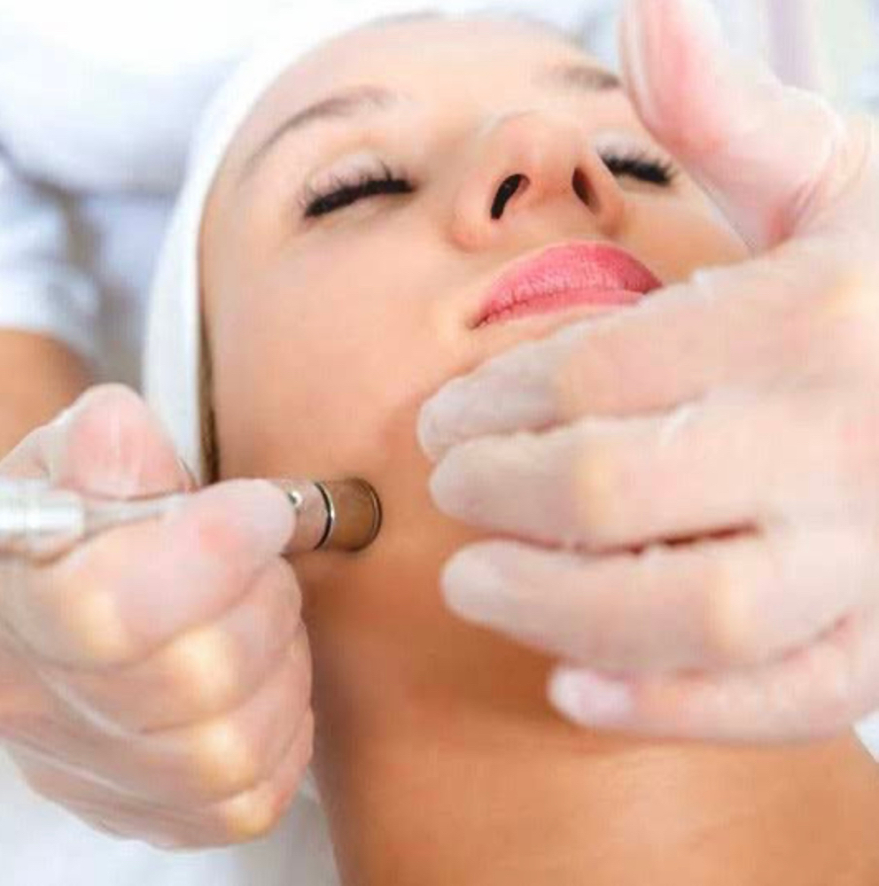 Microderm Facial