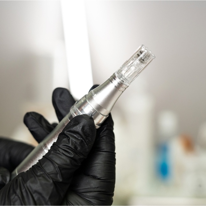 Microneedling (Hand Area)