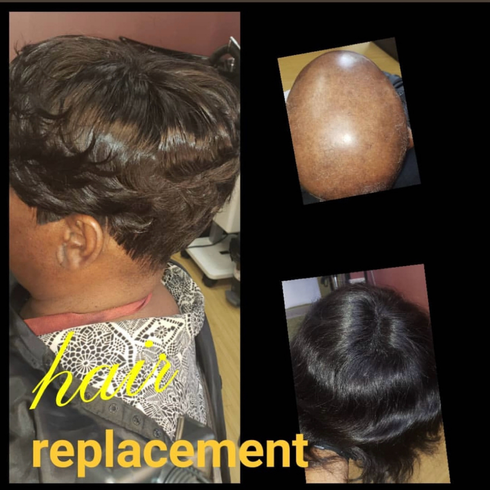 Hair replacement at Follicle Hair Solutions in Luling, LA