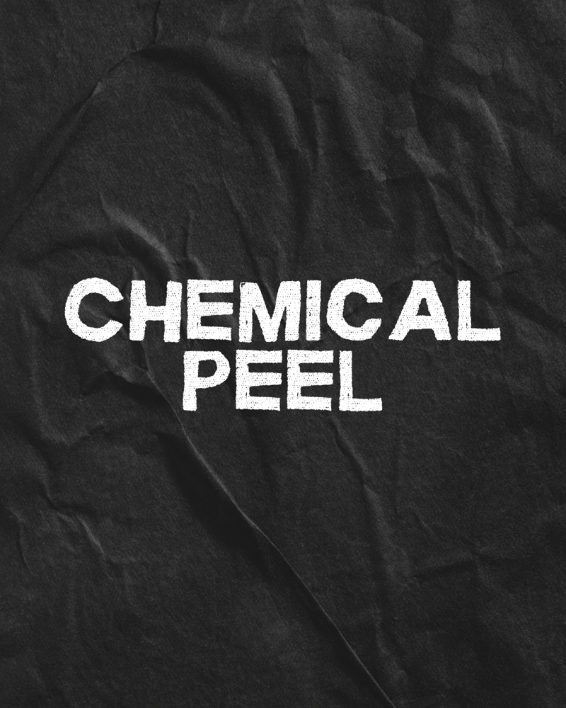 Chemical Peel (30-45 Minutes)