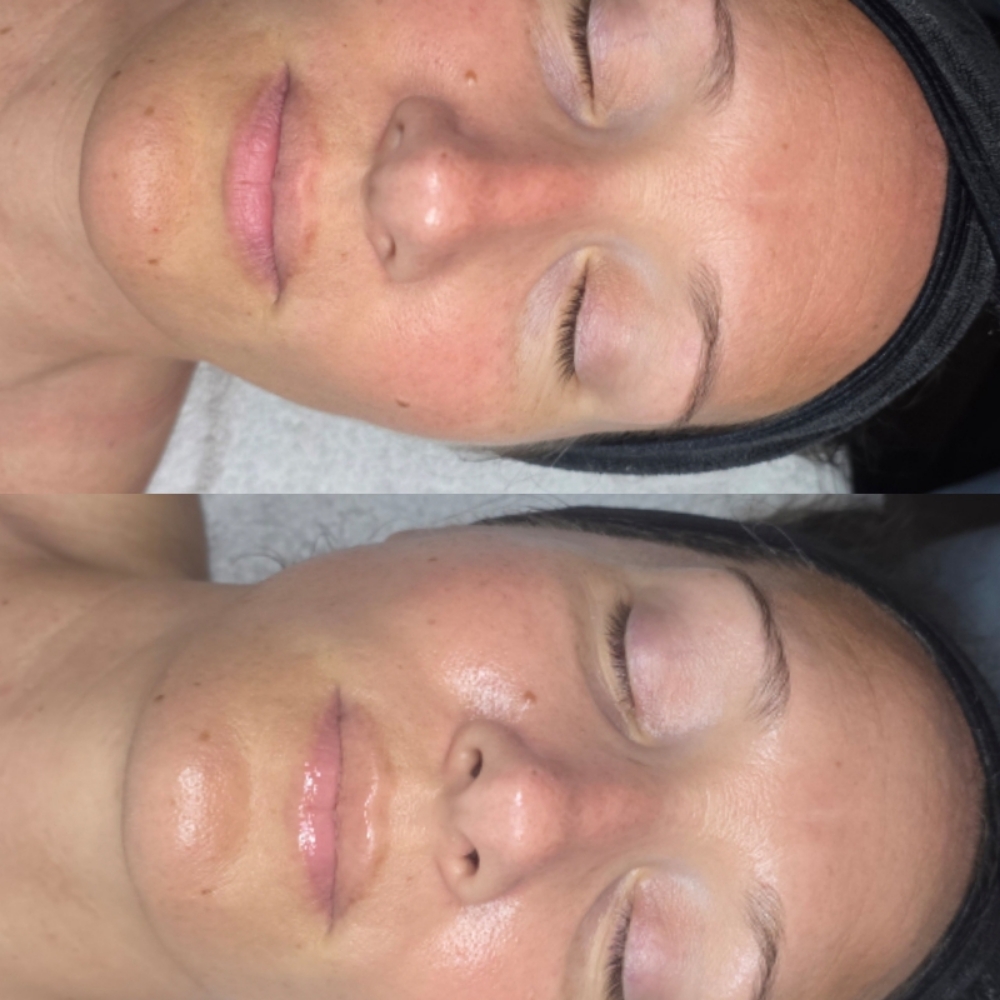 October Special- $130 Signature Der at Caleigh Ann Esthetics in New Port Richey, FL