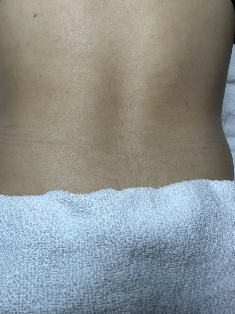 Back Facial
