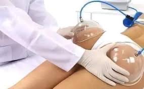 Levantamiento De Gluteos + Vacum