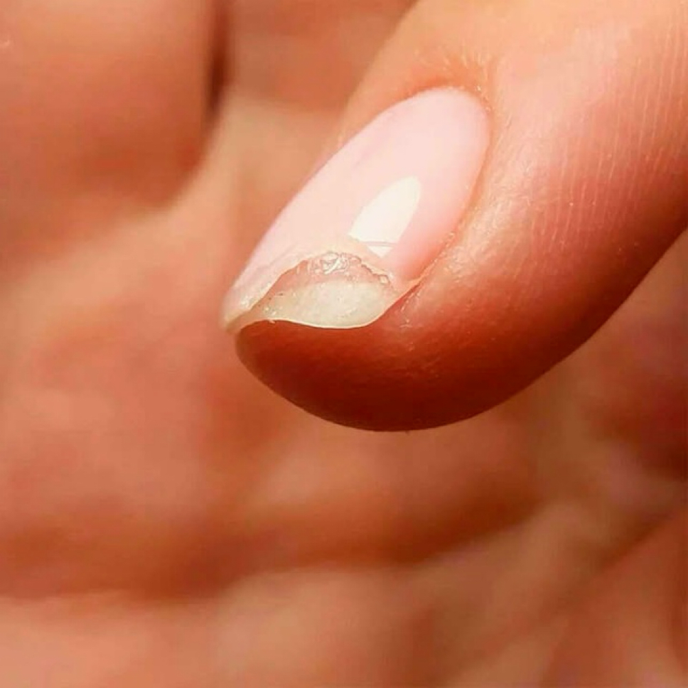 Nail Repair (without manicure) at Russian Claws in Brooklyn, NY