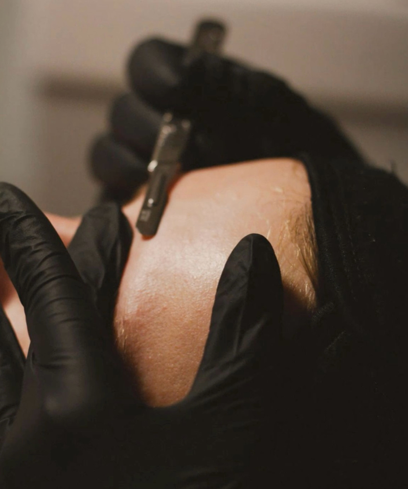 Dermaplane Facial