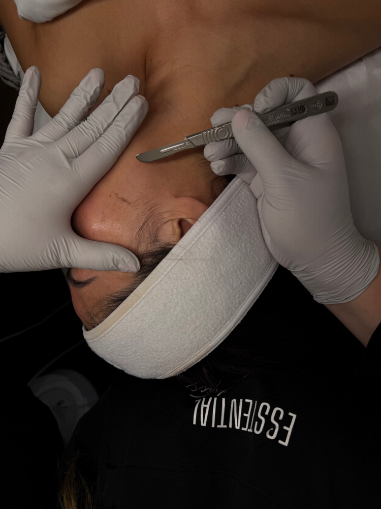 Dermaplane ADD-ON
