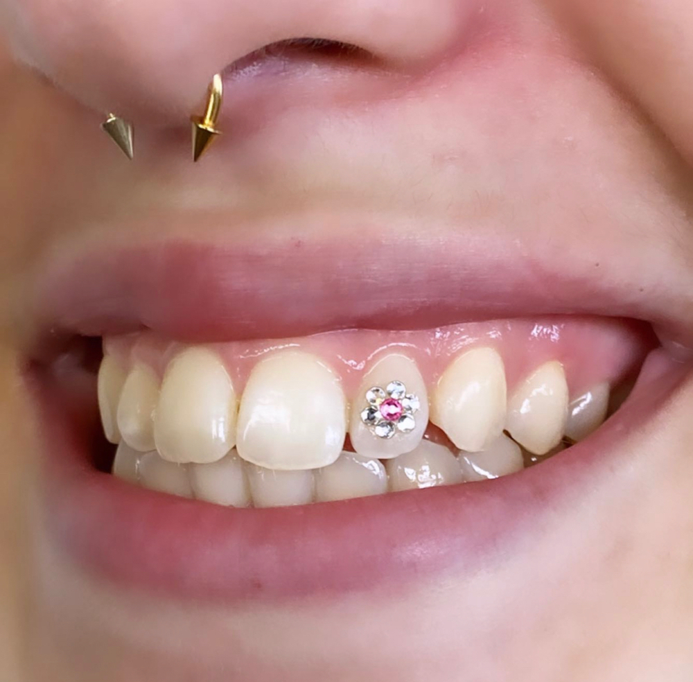 Flower Tooth Gem