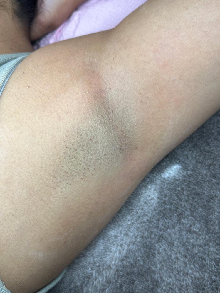 underarm wax