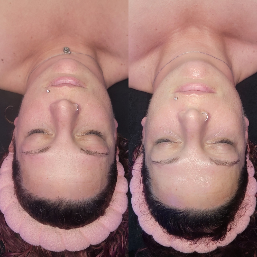 Custom Facial