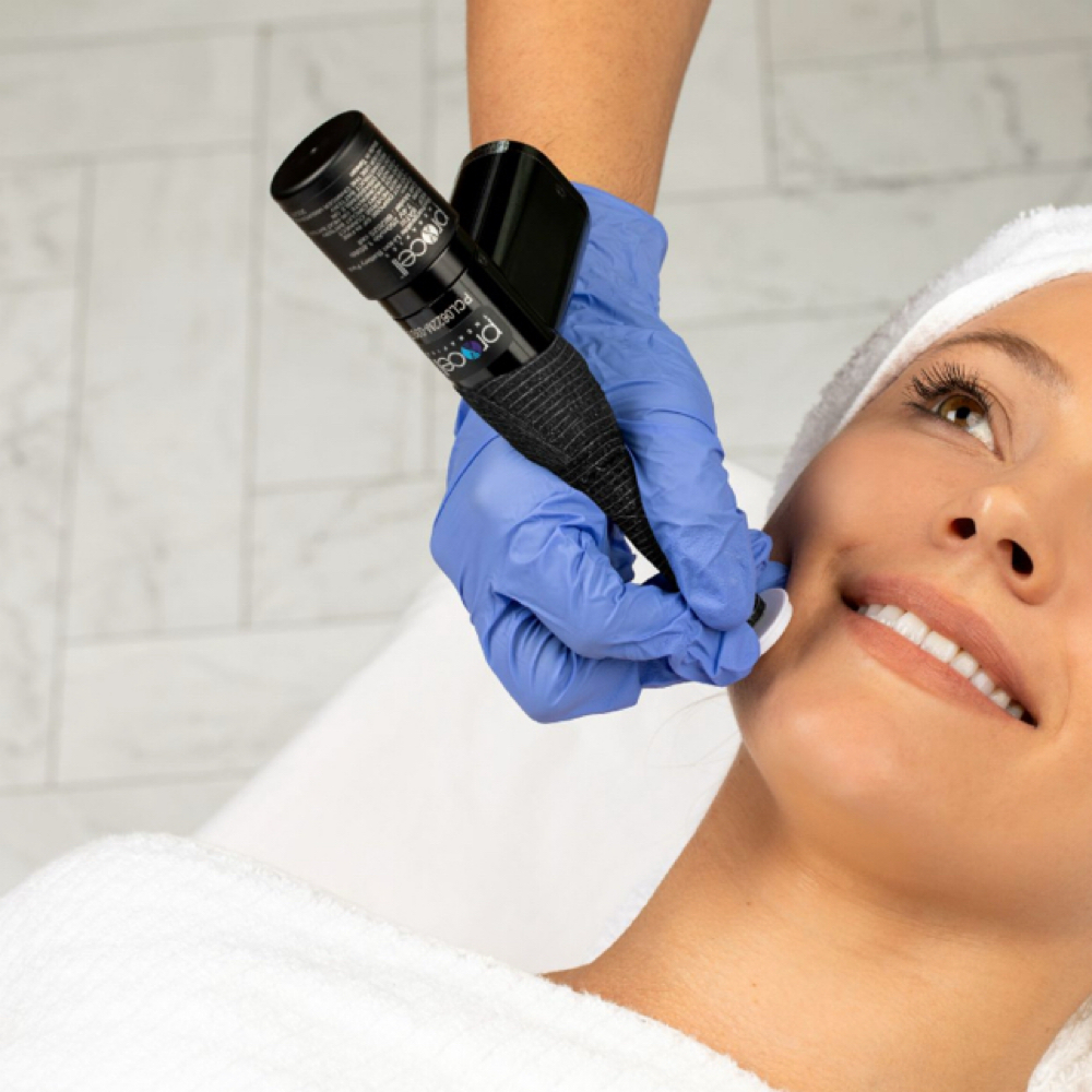 Procell Microchanneling at Radiant Glo Aesthetics in Ottawa, KS