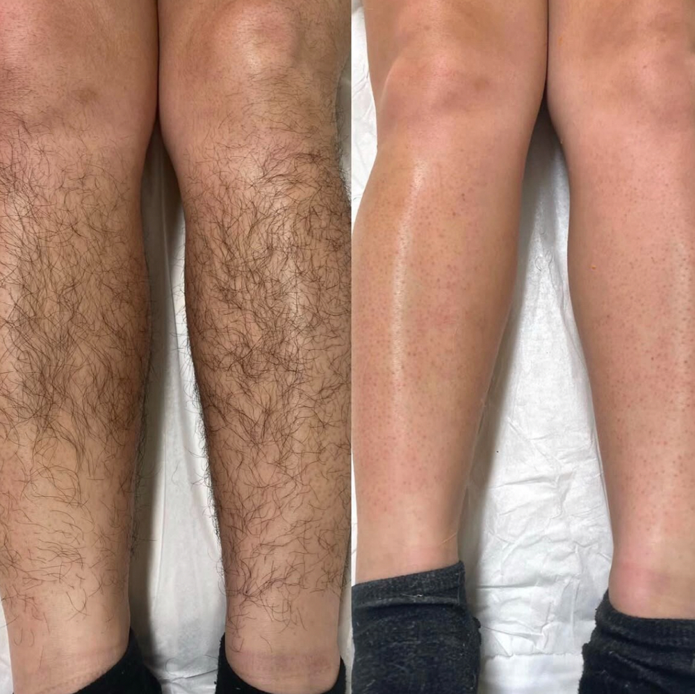 Half Leg Wax/ Upper Or Lower at By Jess LLC in Concord, CA