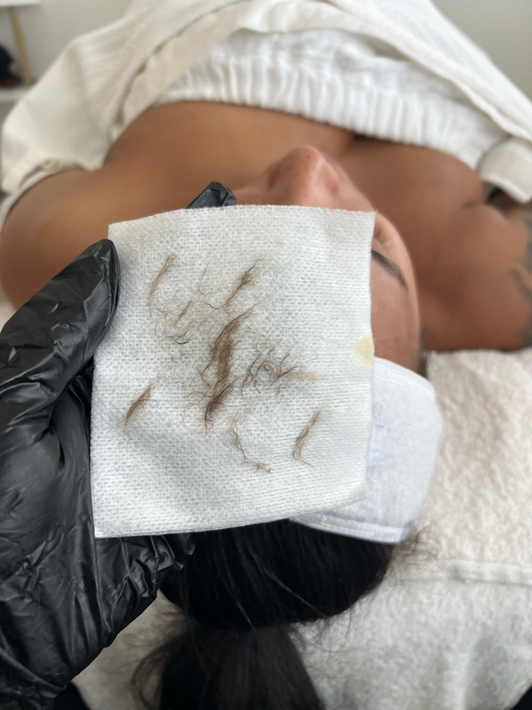 Dermaplaning + Hydro Jelly Facial