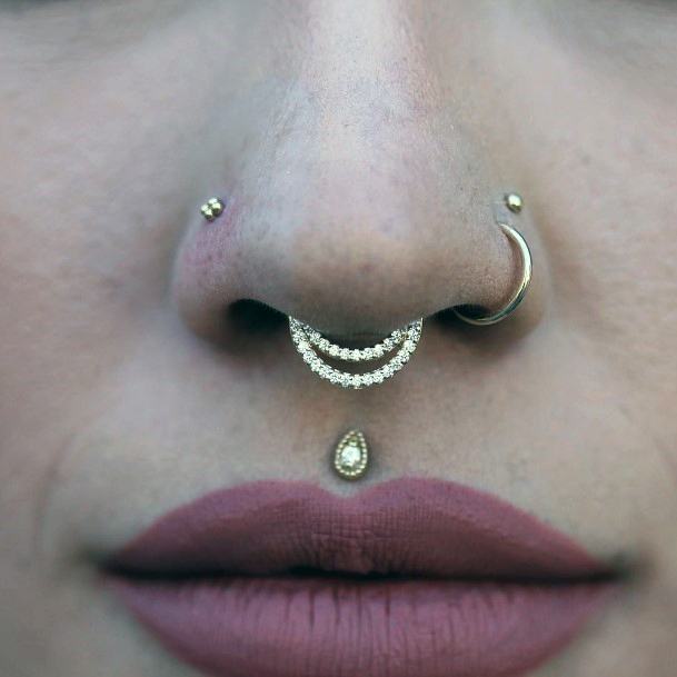 Philtrum