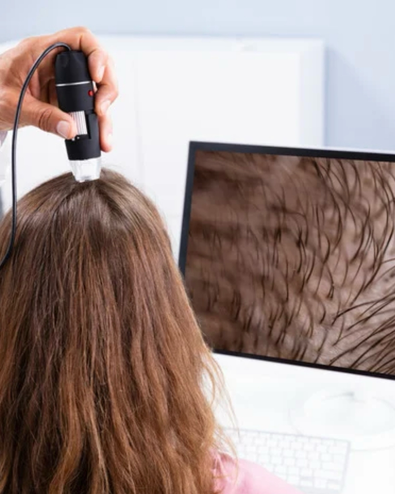 Scalp Rejuvenation Treatment