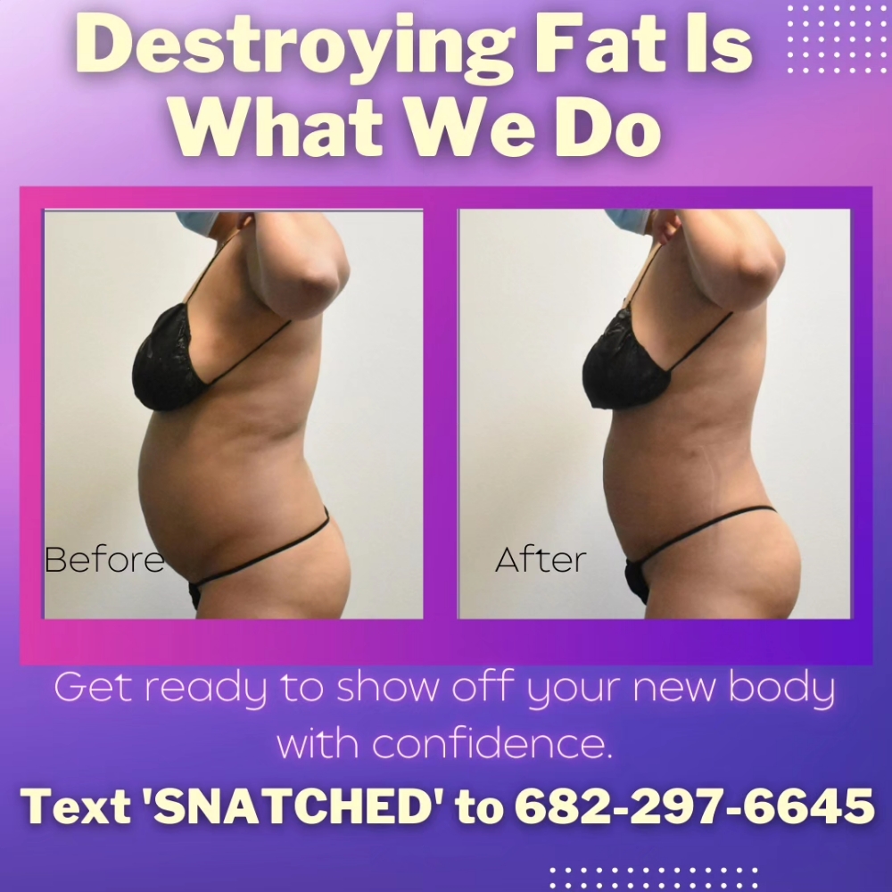 Flabuless 4D 360SlimDown Treatment