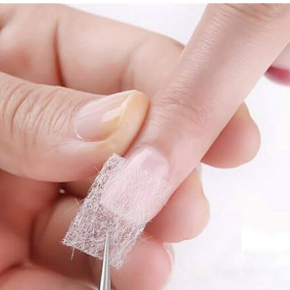 Nail Repair at Carbon Foot Lab in Firestone, CO