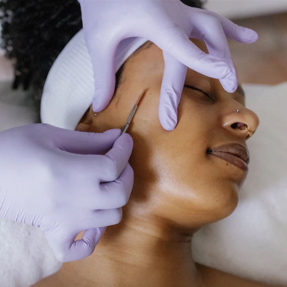 Dermaplane Add-On at No Filter Beauty Bar in Royse City, TX