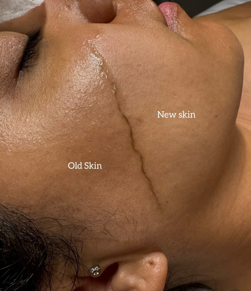 Dermaplane Glow Facial